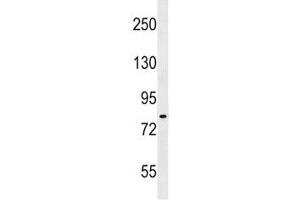 IKK antibody western blot analysis in A549 lysate. (IKK-alpha /IKK-beta 抗体  (AA 155-184))