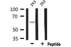Western blot analysis of extracts from 293, using CERKL Antibody. (CERKL 抗体  (Internal Region))