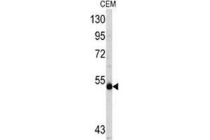 Western blot analysis of MYCN antibody (C-term) in CEM cell line lysates (35ug/lane). (MYCN 抗体  (C-Term))