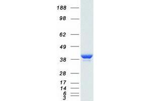 Validation with Western Blot