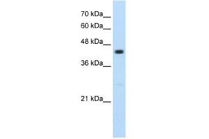 RNF32 antibody used at 2. (RNF32 抗体  (Middle Region))