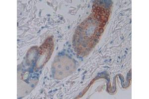 Immunohistochemistry (IHC) image for anti-Sciellin (SCEL) (AA 410-652) antibody (ABIN5014294)