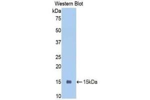 Western blot analysis of the recombinant protein. (PIGR 抗体  (AA 352-457))