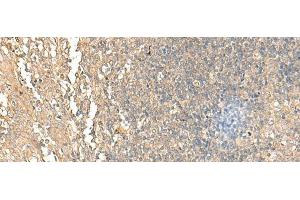 Immunohistochemistry of paraffin-embedded Human tonsil tissue using NARS Polyclonal Antibody at dilution of 1:55(x200) (NARS 抗体)