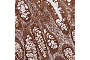 Immunohistochemical staining of human rectum with INO80D polyclonal antibody  shows strong cytoplasmic positivity in glandular cells. (IN80D 抗体)