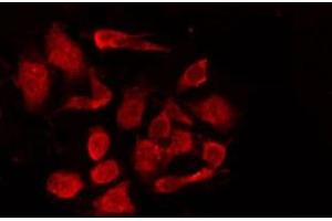 ABIN6267008 staining COS7 by IF/ICC. (KRT15 抗体)
