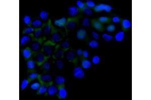 IF analysis of RICTOR using anti-RICTOR antibody (ABIN7600744).