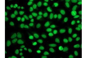 Immunofluorescent staining of HeLa cells using anti-FGFR2 mouse monoclonal antibody (ABIN2454529). (FGFR2 抗体)
