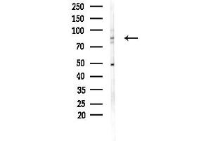 Western blot analysis of lysates from PC12 cells(heat-shock,45 min treatment), using RHG9 Antibody at 1/1000 dilution.