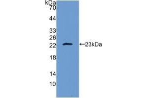 Detection of Recombinant IL10, Human using Polyclonal Antibody to Interleukin 10 (IL10) (IL-10 抗体  (AA 19-178))