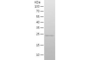 Western Blotting (WB) image for Epithelial Cell Adhesion Molecule (EPCAM) (AA 118-314) protein (His tag) (ABIN7122806)