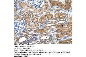 Immunohistochemistry (IHC) image for anti-Neural Precursor Cell Expressed, Developmentally Down-Regulated 9 (NEDD9) (Middle Region) antibody (ABIN2784461)