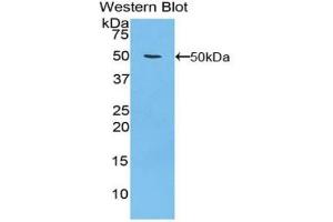 Detection of Recombinant ITGa5, Human using Polyclonal Antibody to Integrin Alpha 5 (ITGa5) (ITGA5 抗体  (AA 895-1049))