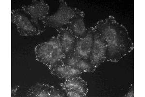 Immunofluorescent staining of A549 cells.