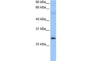 WB Suggested Anti-ROPN1B Antibody Titration: 0. (ROPN1B 抗体  (N-Term))
