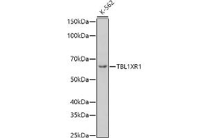 Western blot analysis of extracts of K-562 cells, using TBL1XR1 antibody (ABIN6132717, ABIN6148893, ABIN6148895 and ABIN6217436) at 1:1000 dilution. (TBL1XR1 抗体  (AA 1-180))
