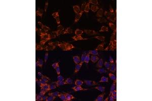 Immunofluorescence analysis of NIH-3T3 cells using UBE2F antibody  at dilution of 1:100.