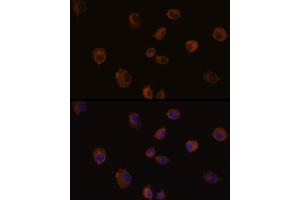 Immunofluorescence analysis of C6 cells using MMP13 Rabbit pAb (ABIN6130559, ABIN6143903, ABIN6143904 and ABIN6215450) at dilution of 1:100 (40x lens). (MMP13 抗体  (AA 262-471))