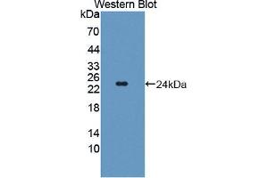 Western blot analysis of the recombinant protein. (TWSG1 抗体  (AA 26-223))