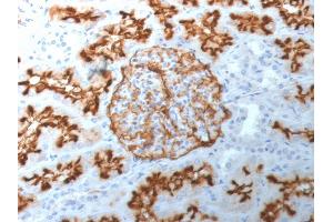 Formalin-fixed, paraffin-embedded human Kidney stained with CD10 Mouse Monoclonal Antibody (MME/1892). (MME 抗体  (AA 297-483))