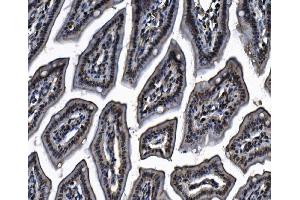 IHC analysis of MCM4 using anti-MCM4 antibody (ABIN7601485). (MCM4 抗体  (AA 361-677))