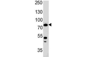 Western blot testing of human HT29 cell lysate with Moesin antibody (clone MSN/491). (Moesin 抗体)