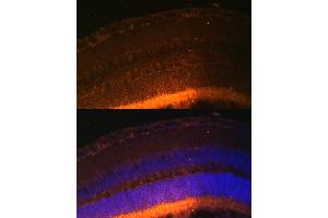Immunofluorescence analysis of mouse retina using GRK1 Polyclonal Antibody (ABIN6134352, ABIN6141414 and ABIN7101798) at dilution of 1:100 (40x lens). (GRK1 抗体  (AA 1-160))