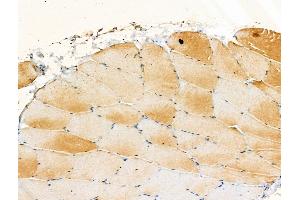 Phospho-A20/TNFAIP3 (Ser381) Antibody at 1/100 staining Rat muscle tissue by IHC-P. (TNFAIP3 抗体  (pSer381))