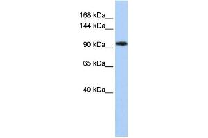 WB Suggested Anti-C11orf9 Antibody Titration:  0. (Chromosome 11open Reading Frame 9 (C11orf9) (N-Term) 抗体)