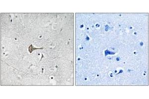 Immunohistochemistry analysis of paraffin-embedded human brain tissue, using Kv4.