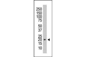 Western Blotting (WB) image for anti-Protein Tyrosine Phosphatase Type IVA, Member 3 (PTP4A3) antibody (ABIN356421) (PTP4A3 抗体)