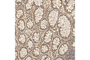 IHC analysis of Citrin/SLC25A13 using anti-Citrin/SLC25A13 antibody (ABIN7599512). (slc25a13 抗体  (AA 1-643))