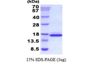 Galectin 2 Protein (AA 1-130) (His tag)