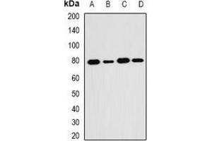 Western blot analysis of SH2B1 expression in HT29 (A), MCF7 (B), mouse kidney (C), mouse brain (D) whole cell lysates. (SH2B1 抗体)