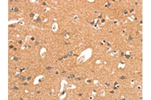 The image on the left is immunohistochemistry of paraffin-embedded Human brain tissue using ABIN7189890(ARHGAP4 Antibody) at dilution 1/25, on the right is treated with synthetic peptide. (ARHGAP4 抗体)