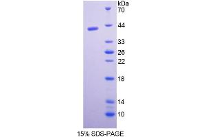 SDS-PAGE analysis of Rat Pepsinogen C Protein. (PGC 蛋白)