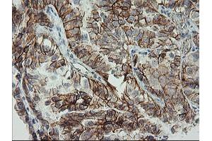 Immunohistochemistry (IHC) image for anti-Cadherin 2 (CDH2) antibody (ABIN1499625) (N-Cadherin 抗体)