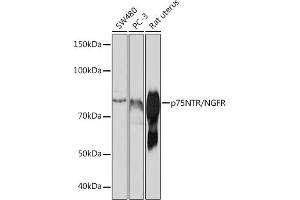 Western blot analysis of extracts of various cell lines, using p75NTR/NGFR antibody (ABIN7268850) at 1:1000 dilution. (NGFR 抗体)