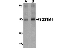 AP20066PU-N SQSTM1 antibody staining of Human Spleen Tissue Lysate by Western Blotting at (A) 1 and (B) 2 μg/ml. (SQSTM1 抗体  (C-Term))