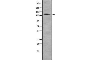 Western blot analysis of CD93 using HeLa whole cell lysates (CD93 抗体  (C-Term))