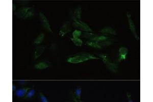 Immunofluorescence analysis of U2OS cells using TGFBR2 Polyclonal Antibody at dilution of 1:100. (TGFBR2 抗体)