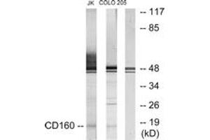 Western blot analysis of extracts from Jurkat/COLO205 cells, using CD160 Antibody. (CD160 抗体  (AA 21-70))