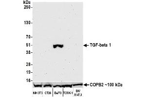 Western Blotting (WB) image for anti-Transforming Growth Factor, beta 1 (TGFB1) (AA 325-375) antibody (ABIN7449529) (Recombinant TGFB1 抗体  (AA 325-375))