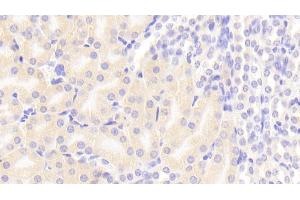 Detection of FADD in Mouse Kidney Tissue using Polyclonal Antibody to Fas Associating Death Domain Containing Protein (FADD) (FADD 抗体  (AA 7-178))