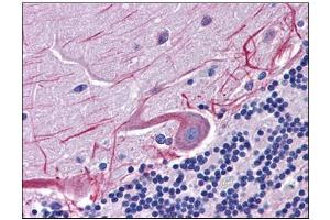 Human Brain, Cerebellum: Formalin-Fixed, Paraffin-Embedded (FFPE) (SKA1 抗体  (C-Term))