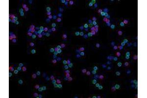 Immunofluorescence (IF) image for anti-CD8a Molecule (CD8A) antibody (Alexa Fluor 594) (ABIN2656837) (CD8 alpha 抗体  (Alexa Fluor 594))