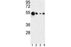 Western blot analysis of AIM2 antibody and 1) MCF-7, 2) HL-60, 3) K562 and 4) HeLa lysate. (AIM2 抗体  (AA 1-50))