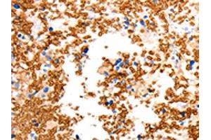 Immunohistochemistry (IHC) image for anti-Solute Carrier Family 2 (Facilitated Glucose/fructose Transporter), Member 5 (SLC2A5) antibody (ABIN7192466)
