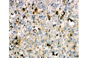 IHC-P: MyD88 antibody testing of human tonsil tissue (MYD88 抗体  (Middle Region))