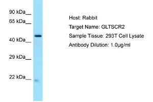 Host: RabbitTarget Name: GLTSCR2Antibody Dilution: 1. (GLTSCR2 抗体  (C-Term))